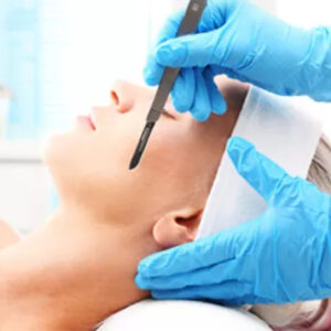 Dermaplaning