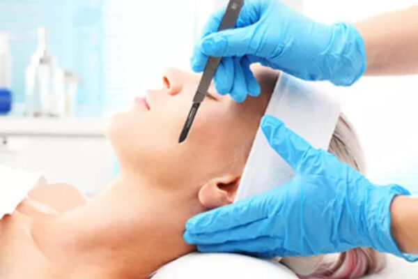 Dermaplaning